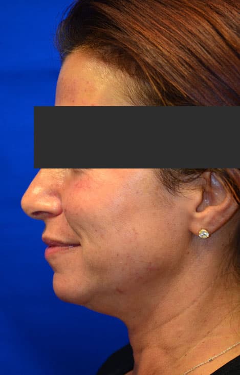Case 1 - Before